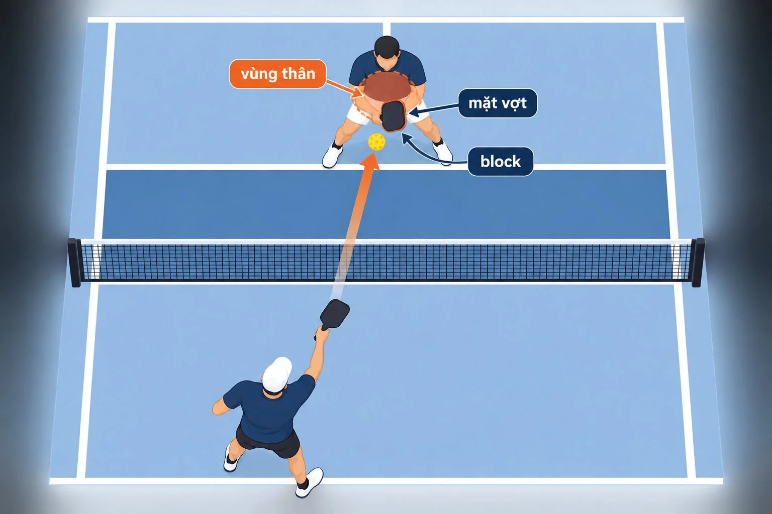 Sơ đồ vùng thân và hướng mặt vợt khi block bóng pickleball